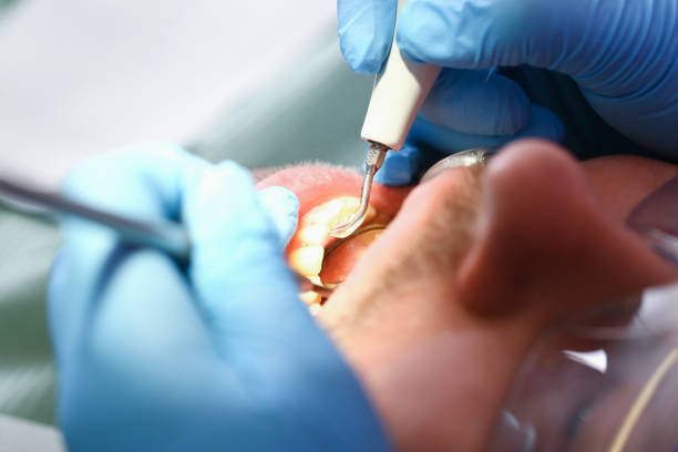 Best Emergency Dentist for Knocked-Out Tooth in Medford, NY